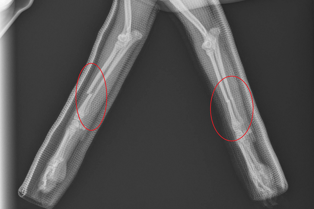 An X-ray of Speedy’s broken legs.